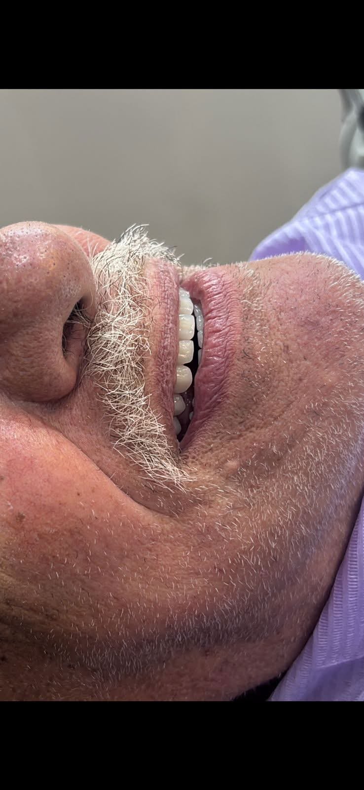 Resultado tratamento 2